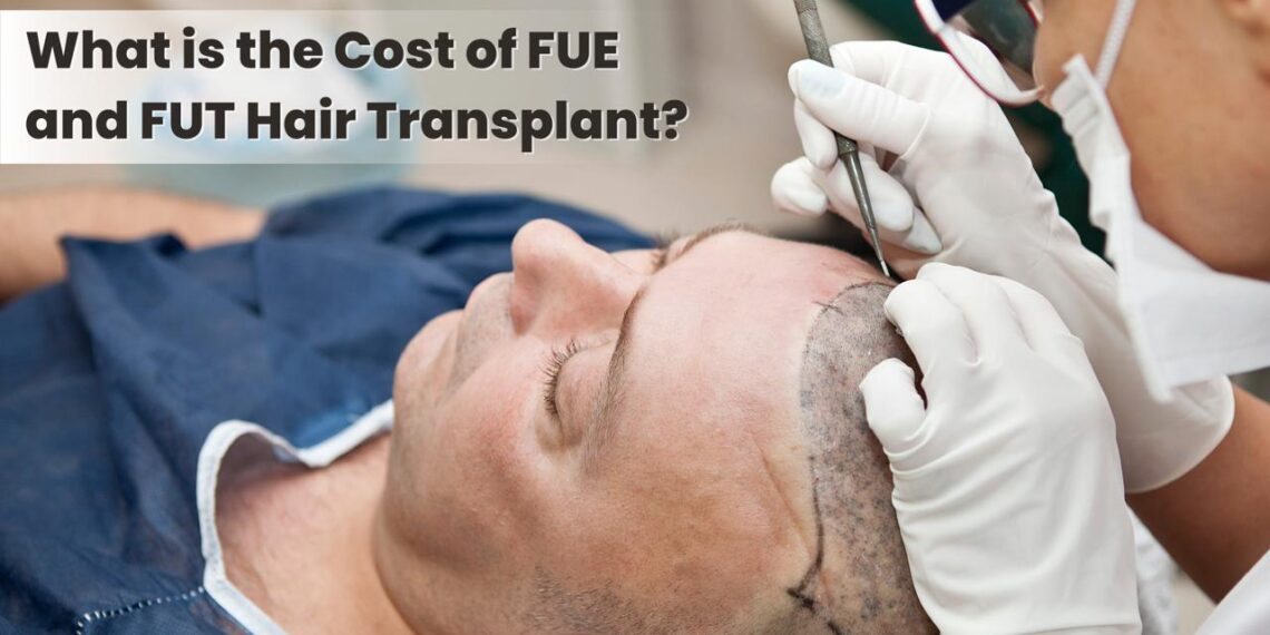 cost of FUE and FUT Hair